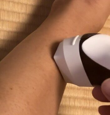 ケノンのハンドピースを肌に当てて照射している様子